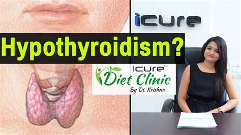 Hypothyroidism Hypothyroidism Natural Remedies And Treatment Icure