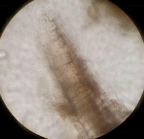 Burmanni Cortex Fnosi Mikroskopis
