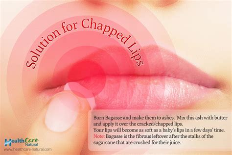 solution for chapped lips healthcare natural cure for chapped lips chapped lips remedy lips