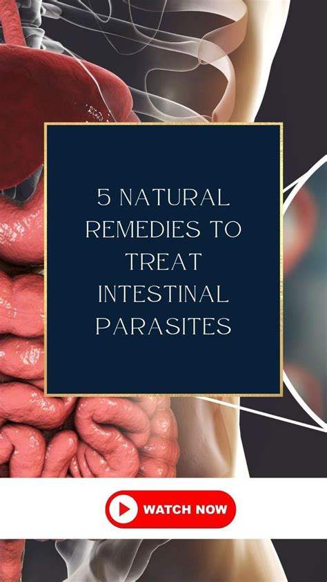 5 Natural Remedies To Treat Intestinal Parasites Intestinal Parasites Parasite Cleanse