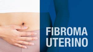 Fibroma Uterino Sintomi E Cura Del Tumore Benigno C D V