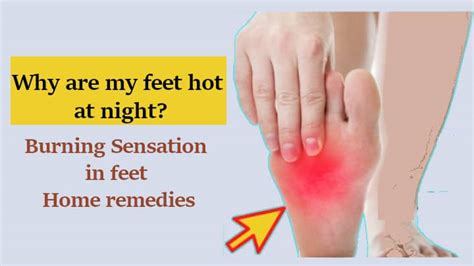 Burning Sensation In Feet Home Remedies And Prevention
