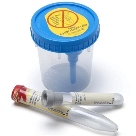 Buy BD Vacutainer Urine Collection System Get Price For Lab Equipment