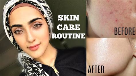 My Simple Skincare Routine For Clear Glowing Skin