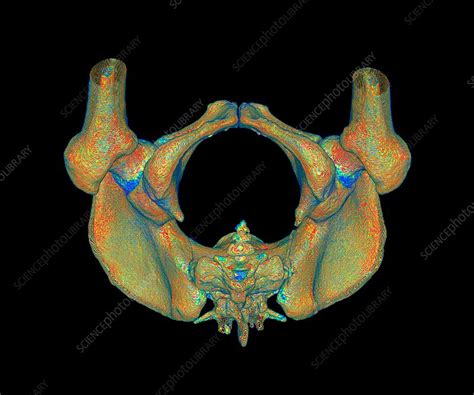 Female Pelvis 3d Ct Scan Stock Image C0360503 Science Photo Library