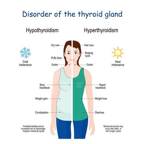 Thyroid Disorders Overview Causes Symptoms Treatment