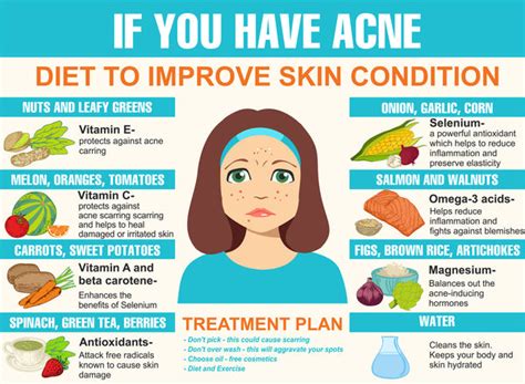What Foods Help Prevent Acne