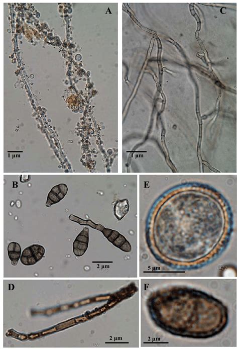 Examples Of Photos Of Fungi Hyphae And Spores From Alps Snow Mt Blanc