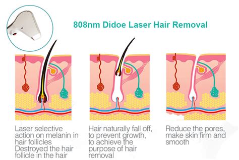 If you are planning to buy an intense pulsed light machine for upgrading your salon, keep some technical specifications in mind. Portable & Latest Purchase Laser Hair Removal Machine ...