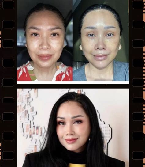 Titi DJ Tampak Lebih Muda Karena Lakukan Anti Aging, Operasi Apa Itu