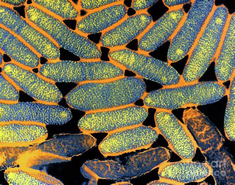 Tem Of Legionella Pneumophila Bacteria Photograph By A Dowsett
