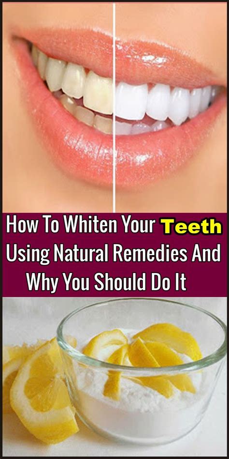 How To Whiten Your Teeth Using Natural Remedies And Why You Should Do It