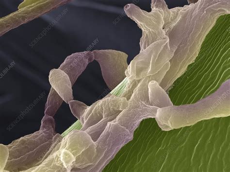 Apple Tree Fungus Sem Stock Image C0124936 Science Photo Library