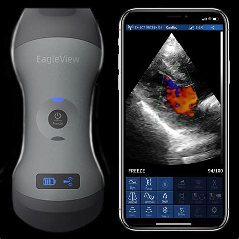 Eagleview Dual Head Wireless Handheld Ultrasound