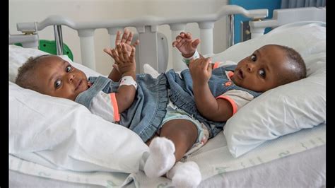 Conjoined Twins From Nigeria Separated At Le Bonheur Childrens