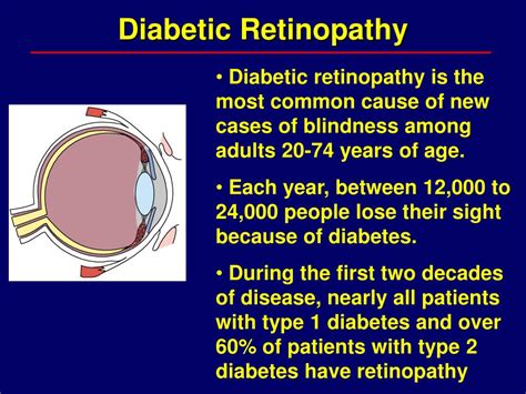 Ppt Diabetic Retinopathy Powerpoint Presentation Free Download Id