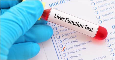 Post covid health checkup packages. Lower SGPT & SGOT Level Naturally | Avoid Liver Damage