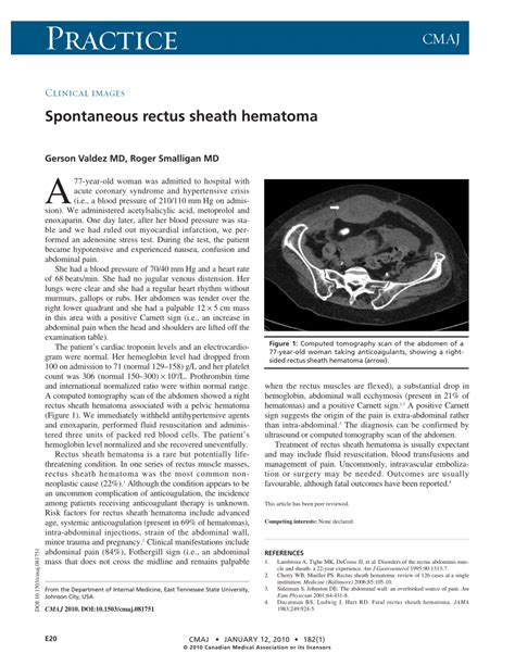 Pdf Clinical Images Spontaneous Rectus Sheath Hematoma