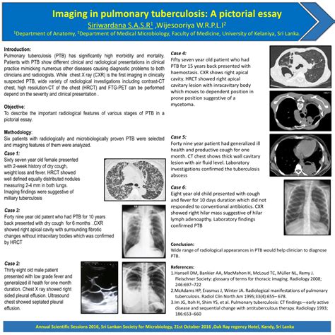 Pdf Imaging In Pulmonary Tuberculosis A Pictorial Essay