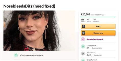 Transgender Tiktok Star Receives £20k From Fans To Fund Reassignment