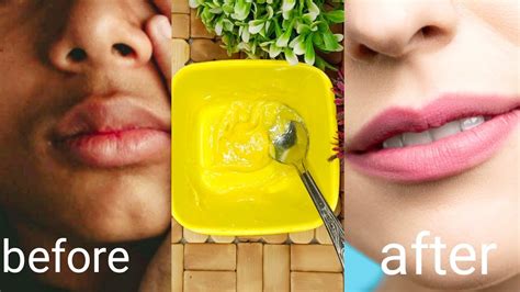 Get Soft Pink Lips In 7 Day At Home Naturally100 Workingdiy Lip