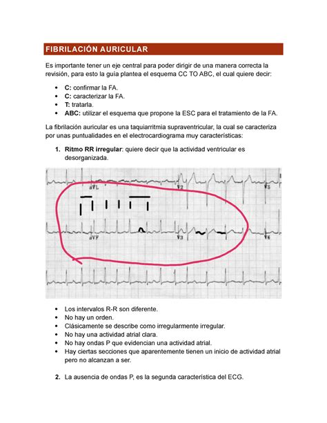 Fibrilación Auricular FibrilaciÓn Auricular Es Importante Tener Un