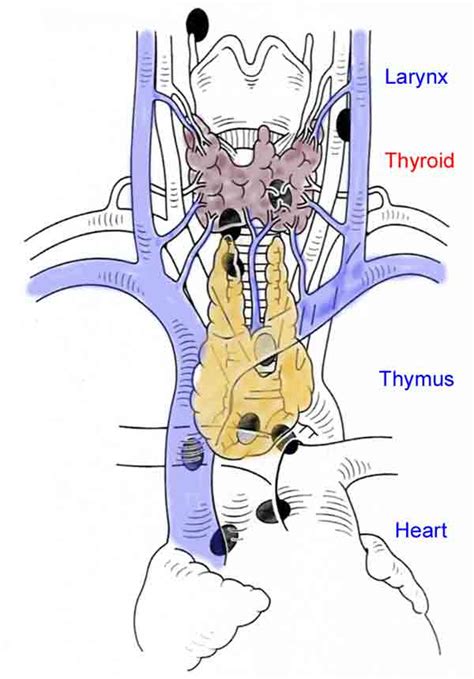 Parathyroid Gland Diagram