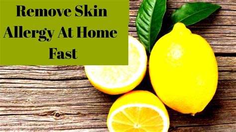Skin Allergy Treatment Get Rid Of Skin Allergies At Home Fast Best
