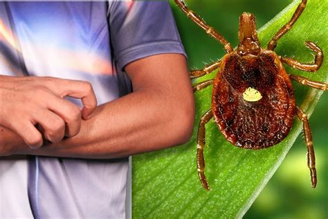 Report Lone Star Tick Spreading Red Meat Allergy Across Us