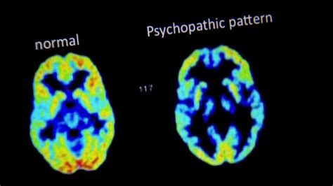 More Brain Points You Should Be A Psychopath