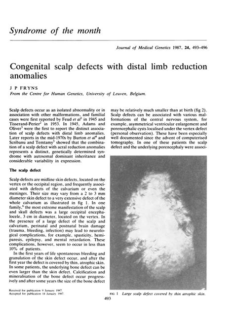 PDF Congenital Scalp Defects With Distal Limb Reduction Anomalies