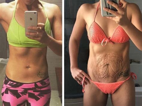 Mum Flaunts Saggy Stomach At Fitness Competitions After Postnatal