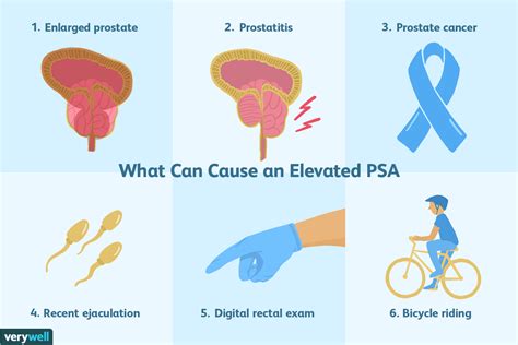 Prostate Specific Antigen Psa Test Purpose And Results
