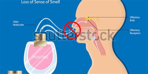 Anosmia is nothing but the salient loss of smell that the majority of us often tend to struggle with, because of certain conditions that affect this. Síntomas más allá del coronavirus