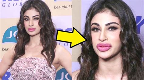 Mouni Roy After Plastic Surgery Gone Wrong Youtube