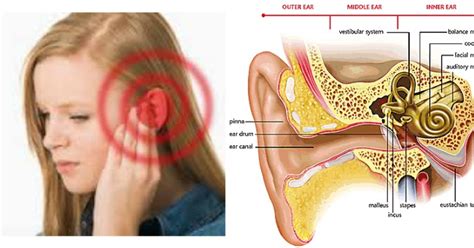 Dok, telinga sebelah kiri saya kemasukan air dan sampai beberapa hari masih tetap sama, suara2 jadi terdengar berdengung / terhalang. Cara Mengobati Telinga Berdengung / Berdenging / Tinnitus ...