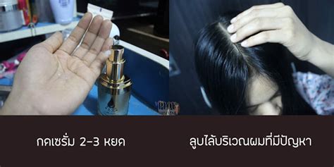 And we're definitely advising you to pop one into there are a multitude of hair serums out on the market so we'd thought we'd help you narrow down your search for one (in the event you're having a. มารู้จักกับ 8 เซรั่ม ที่ชาว Pantip นิยมใช้บำรุง+ปลูกผมกัน ...
