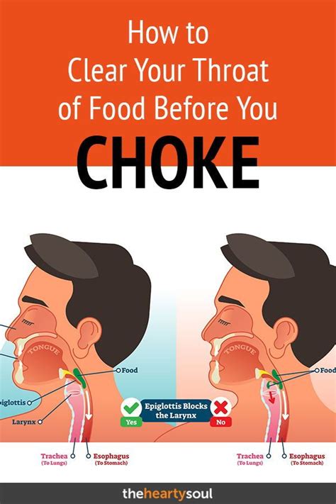8 How To Get Food Stuck In Throat Out Viral Hutomo