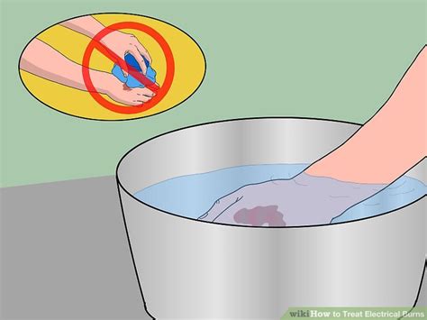 How To Treat Electrical Burns With Pictures Wikihow