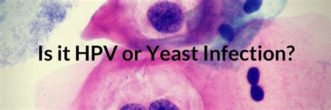 Vaginal Yeast Infection Symptoms Archives Let S Beat Yeast Infections