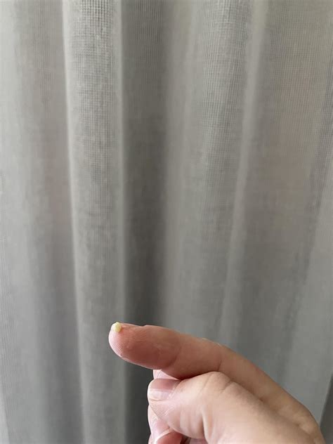 Stinky breath… sore throat… went digging and discovered stinky gold! My