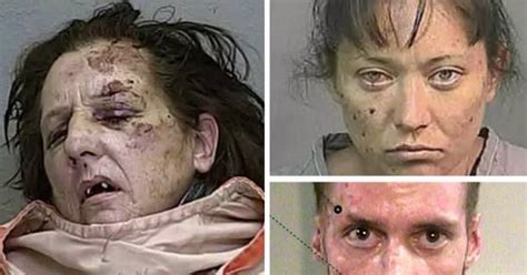Revealed The Horrors Of Crystal Meth Most Shocking Ever Before And After Pictures Daily Star