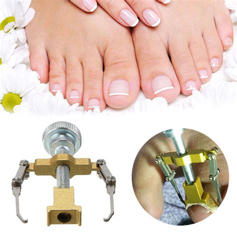 Uña encarnada Manicura Pedicura Cuidado Pie corrección Brace