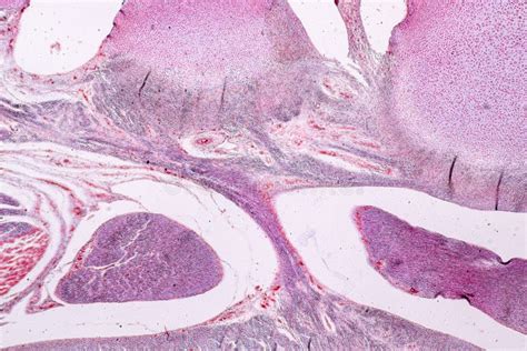 Study Histology Of Human Tissue Bone Under The Microscopic Stock