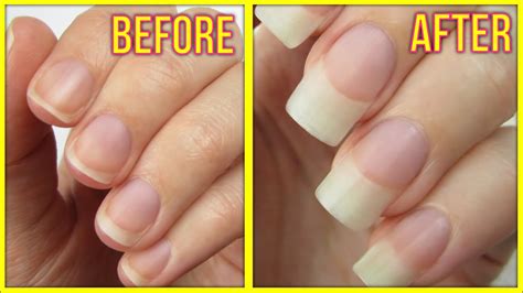 5 Ways To Grow Your Nails Fast Youtube