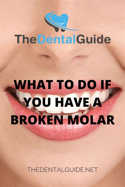 What To Do If You Have A Broken Molar The Dental Guide