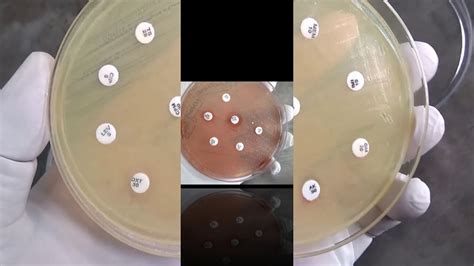 Pigmentation Of Pseudomonas Pyocyanin Proverdin Pyorubrin And