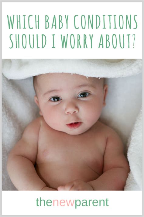 Newborn Baby Care A Guide To The Most Common Baby Conditions Kids