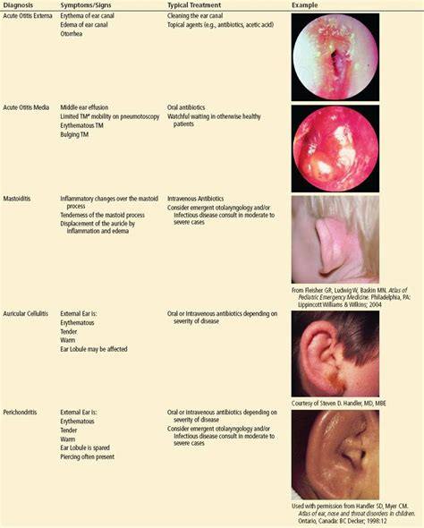 Middle Ear Conditions Chart 20x26 Middle Ear Ear Anat
