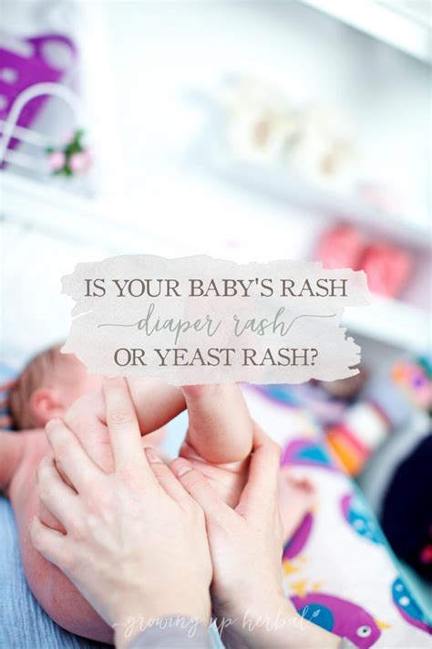 Difference Between Diaper Rash And Yeast Infection Pictures The Meta